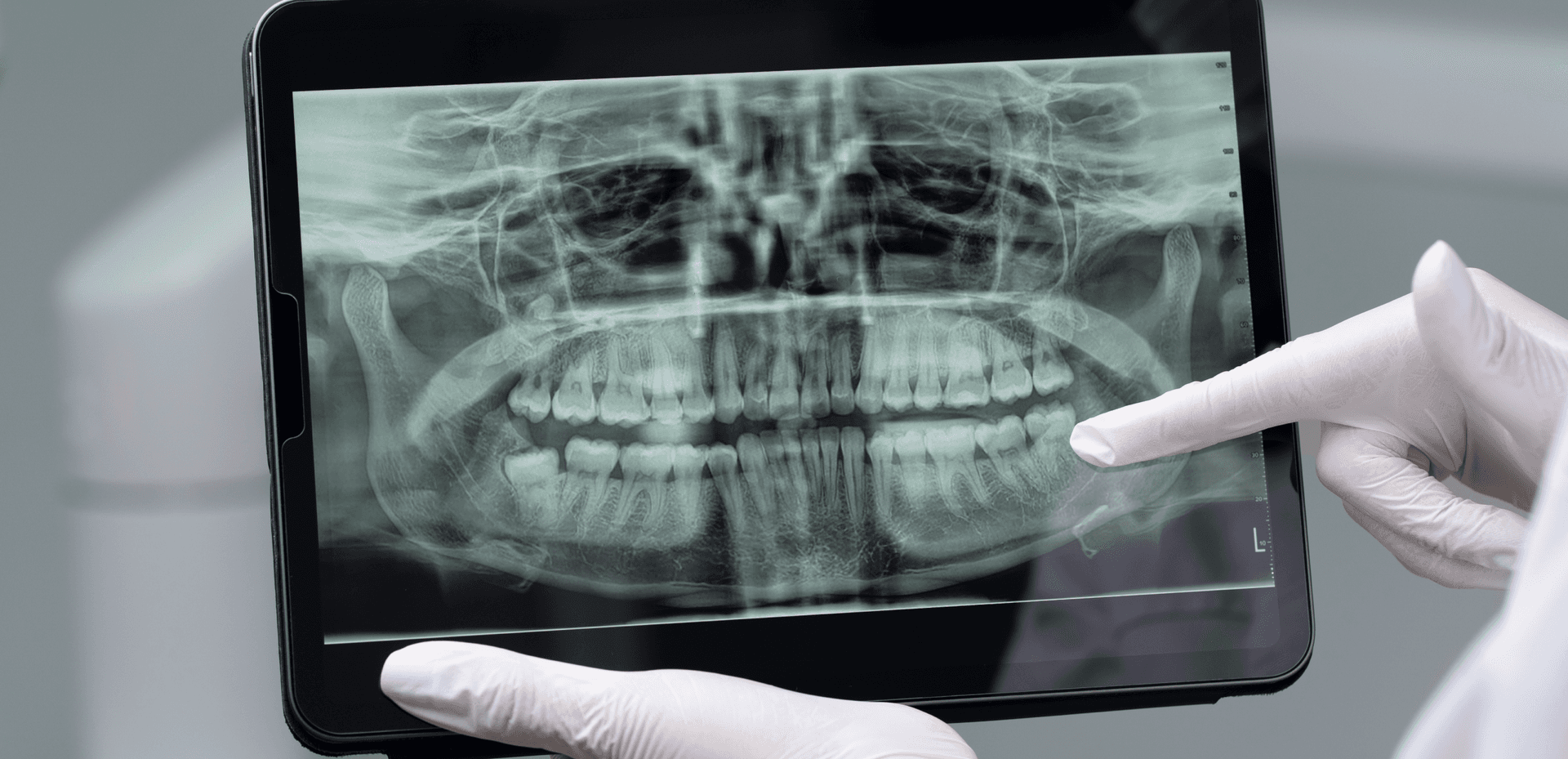 Orthodontist AI - Transforming Orthodontic Care with AI Precision