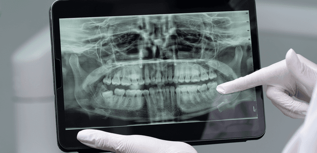 Orthodontist AI - Transforming Orthodontic Care with AI Precision
